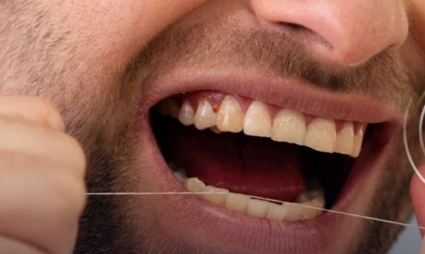 از سوزن‌ها متنفرید؟ واکسن بعدی شما می‌تواند روی یک نخ دندان باشد